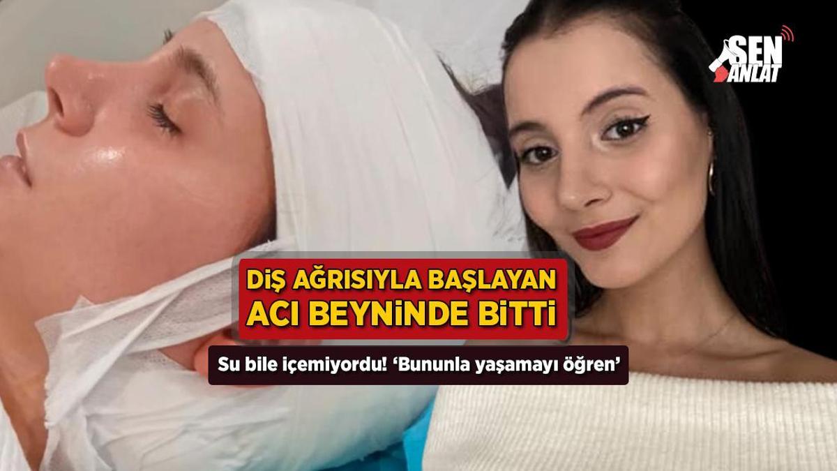Diş ağrısı beyinle ilgili olabilir mi? Çağla Irmak Yıldırım yaşadıklarını paylaştı