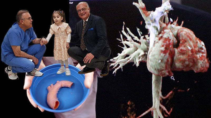 Kalbi 'yatay' doğdu, Türkiye'de ilk kez yapılan ameliyatla sağlık buldu; dünyada ikinci vaka olarak kayıtlara gecti
